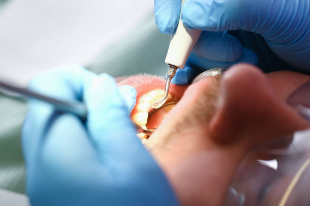 Best Emergency Broken Tooth Repair in Armada, MI