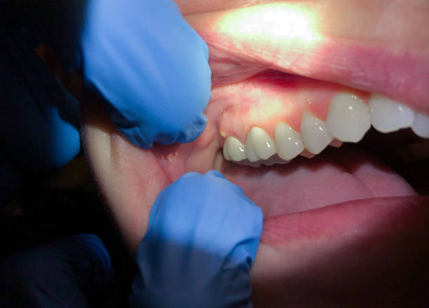 Best Emergency Tooth Extraction in Armada, MI